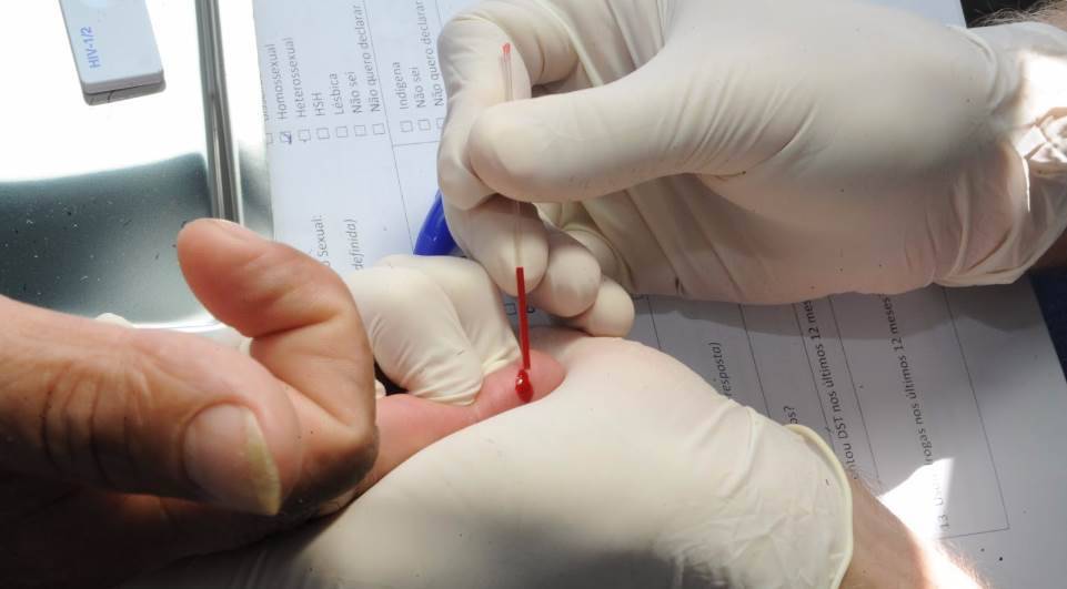  Aids: número de mortes tem redução de 7,2% desde 2010 na Bahia