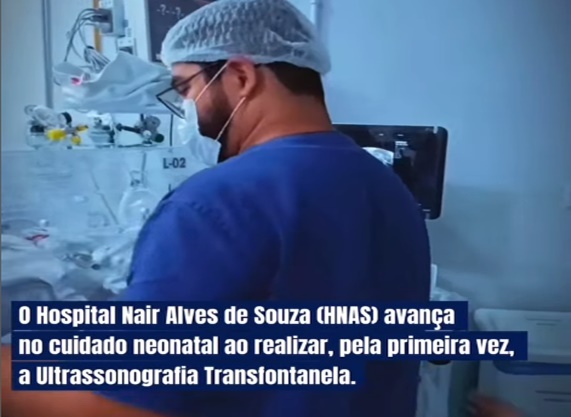  Hospital‎ Nair‎ Alves‎ de‎ Souza‎ realiza‎ primeira‎ Ultrassonografia‎ Transfontanela‎ à‎ beira-leito‎ na UCI‎ Neonatal